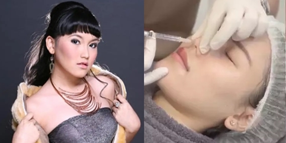 8 Potret Ayu Ting Ting Sebelum VS Sesudah Tanam Benang di Hidung, Dikritik Netizen: Lebih Suka yang Dulu!