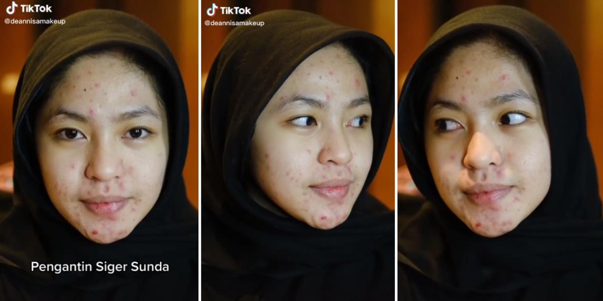 Transformasi Makeup Pengantin Siger Sunda Penuh Jerawat di Wajah, Aslinya Cantik Kini Terlihat Natural dan Tambah Cetar