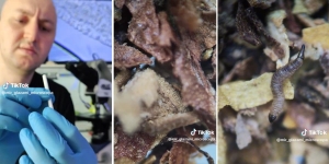 Masih Berani Merokok? Lihat Isi Batang Rokok Dengan Mikroskop, Penuh Binatang Menjijikkan
