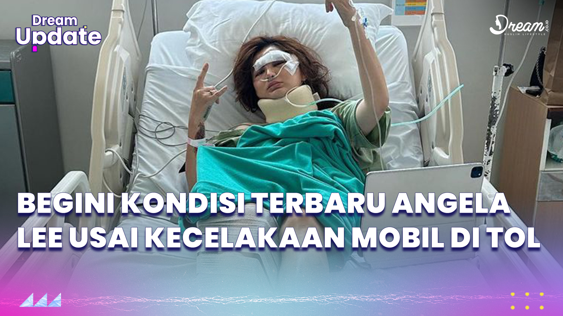 Alami Kecelakaan Mobil, Kondisi Angela Lee Memprihatinkan