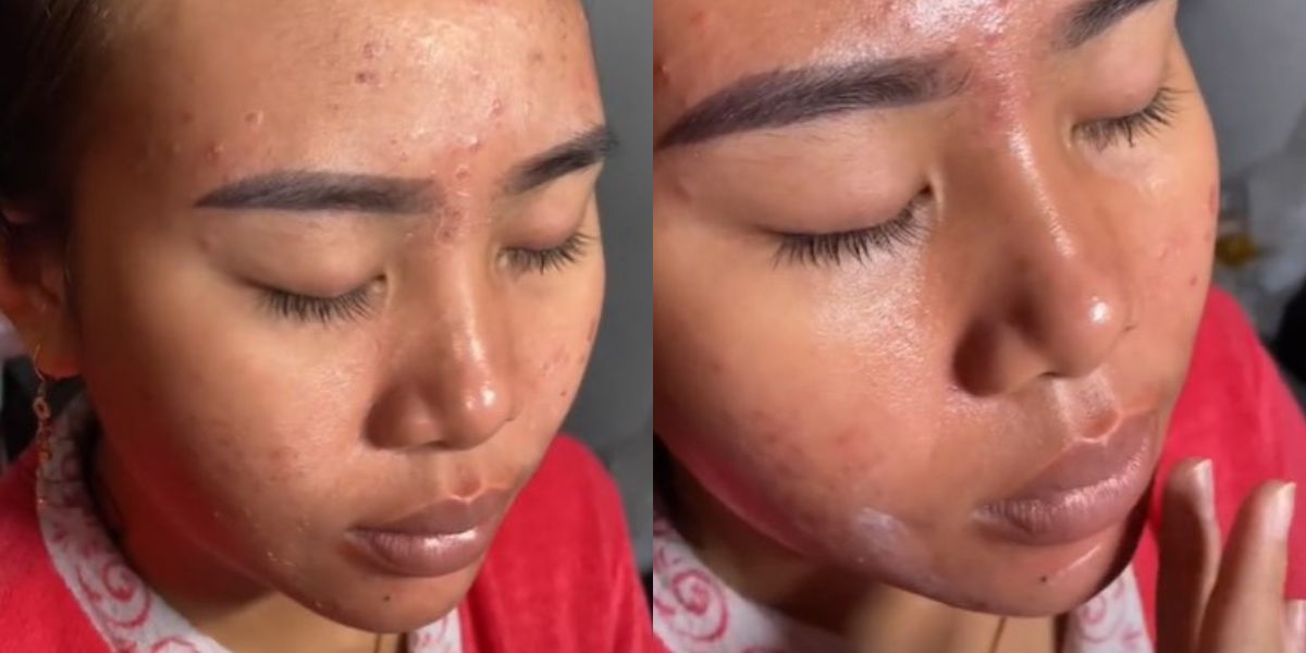 Wajah Pengantin Mengelupas Akibat Peeling, MUA Berhasil Bikin Makeup Smooth