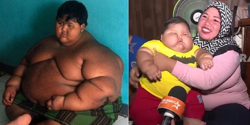 9 Potret Orang-Orang Obesitas yang Viral, Terakhir Paling Parah, Beberapa Sudah Meninggal Dunia!
