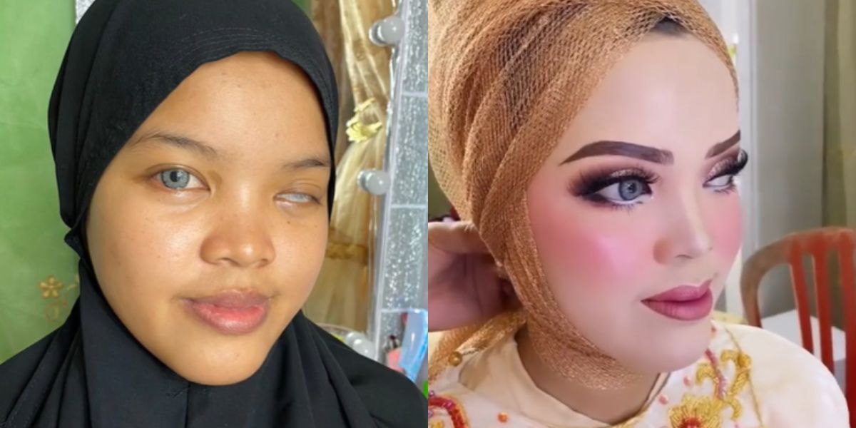 Bikin Pangling! Before After Pengantin Wanita Disabilitas Usai Pakai Makeup