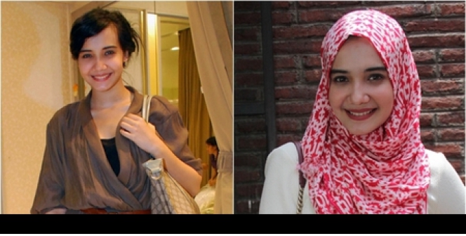 Foto Before After Seleb Cantik Berhijab Foto 7 Dream 