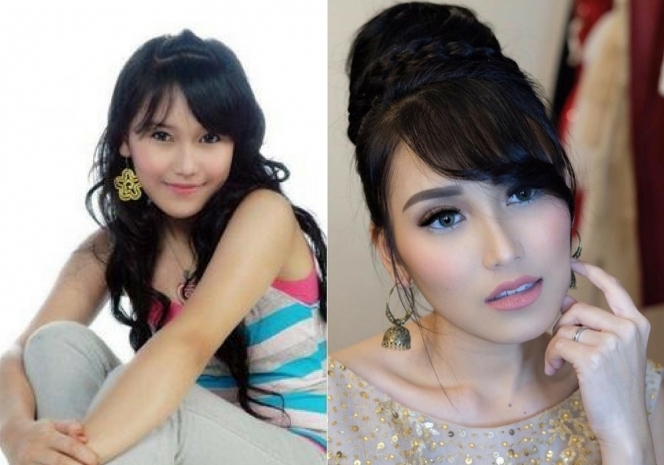 Potret Artis Sebelum Vs Sesudah Mengenal Perawatan Cita Citata Beda Banget Photo