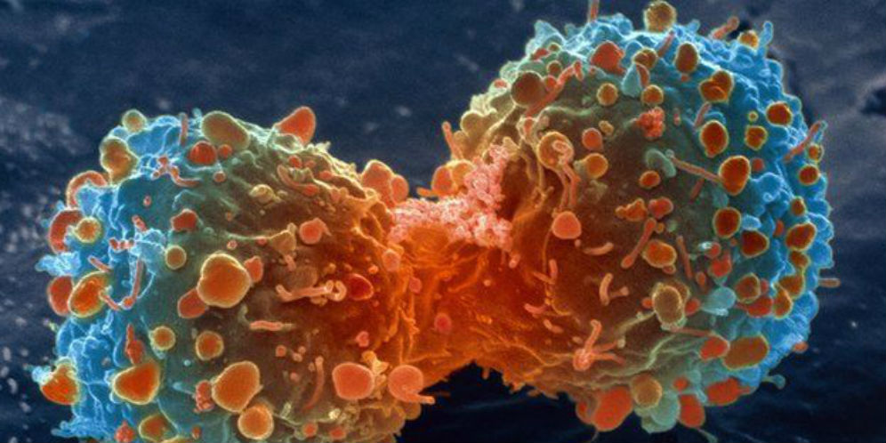 Ilmuwan Berhasil Ciptakan 'Granat' Pembasmi Sel Kanker