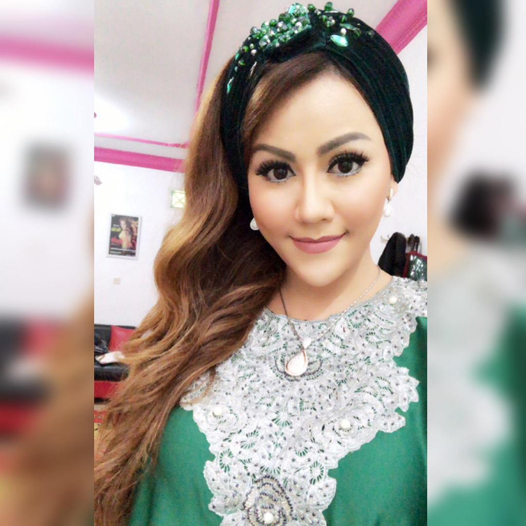 Penampilan Nita Thalia Sehabis Oplas, Beda Banget! | Dream.co.id