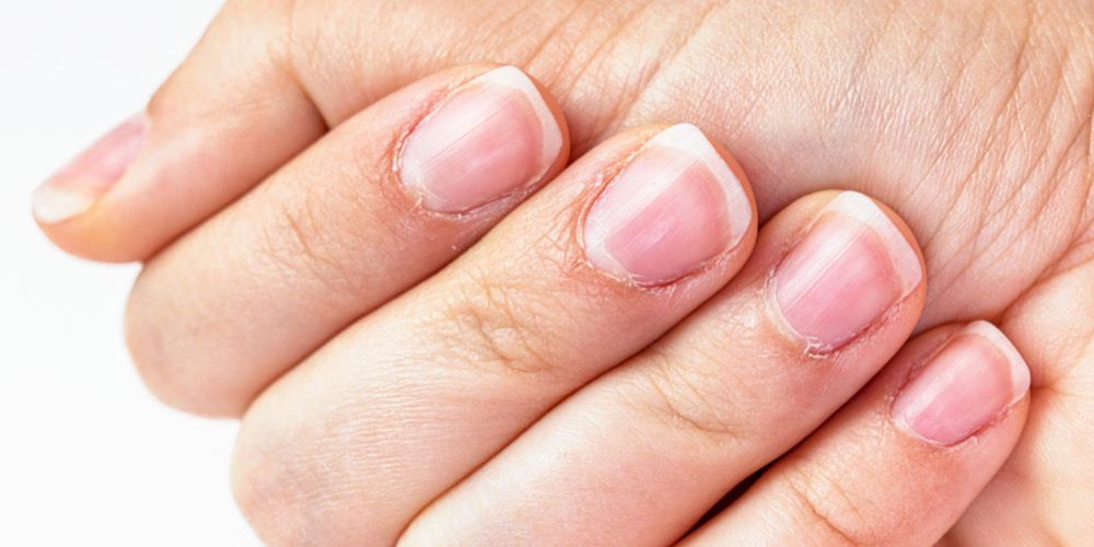 Causes of Slow Nail Growth