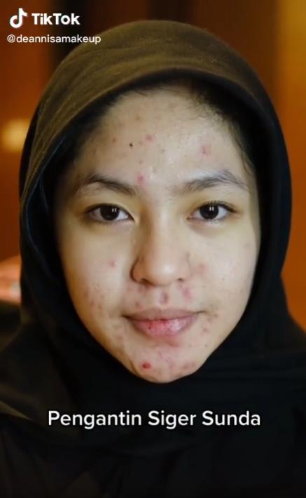 Transformasi Makeup Pengantin Siger Sunda Penuh Jerawat Di Wajah Aslinya Cantik Kini Terlihat