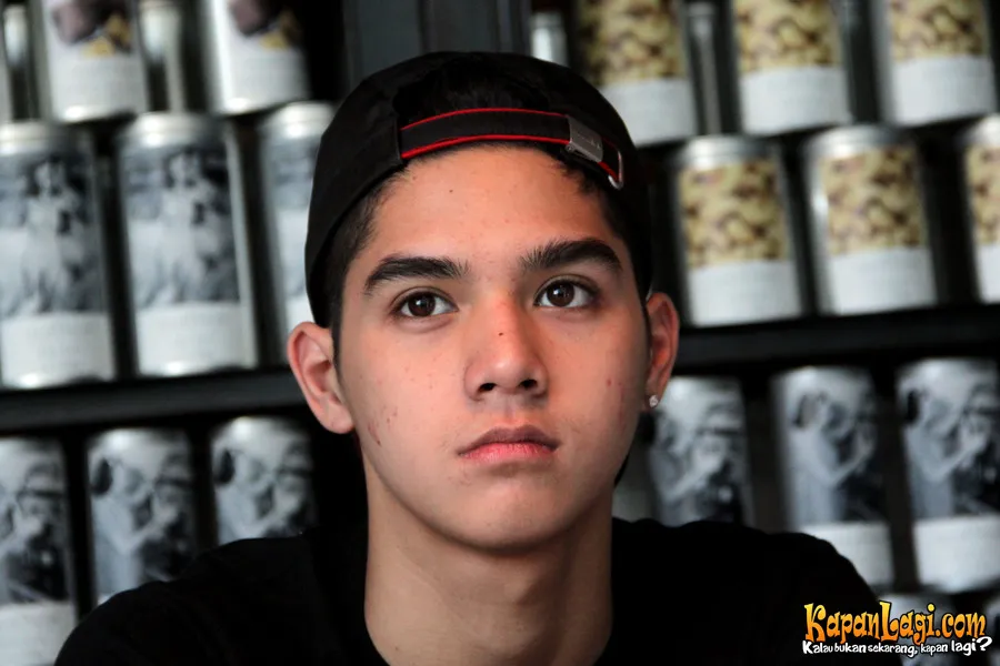 Jerawat Al Ghazali, tetap kelihatan ganteng kan? @KapanLagi.com®