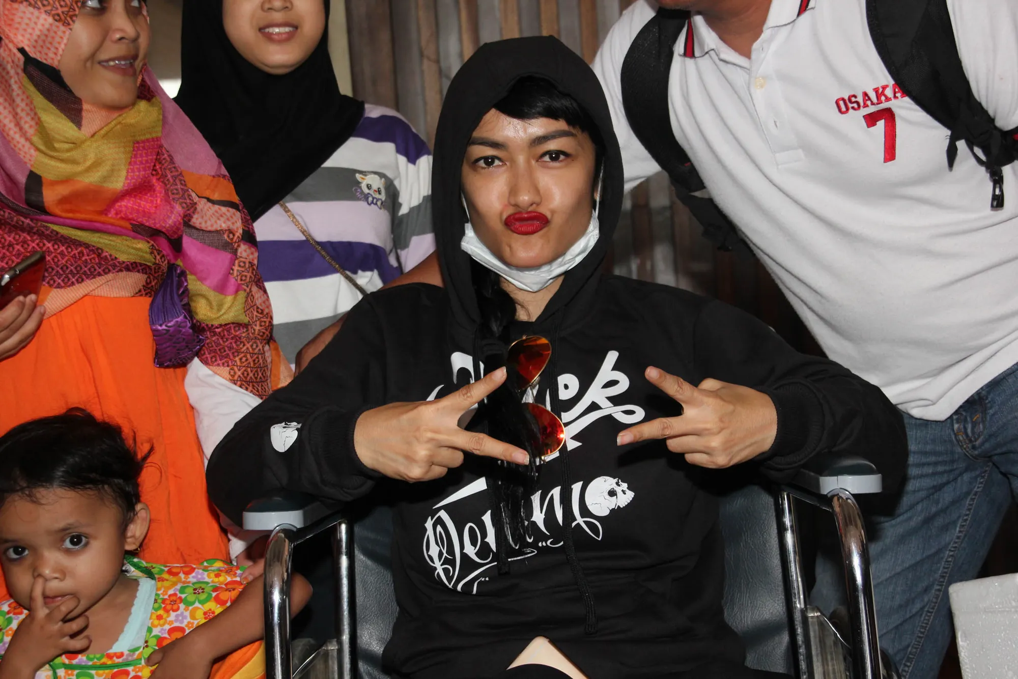 Jupe lega, kini ia sudah sembuh. @KapanLagi.com®/Hendra Gunawan