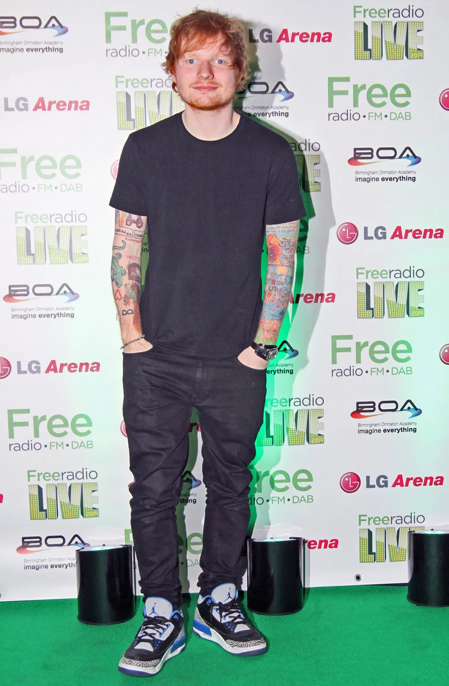 Ed Sheeran harus menjalani tahun baru dengan serangkaian perawatan medis © splashnews.com