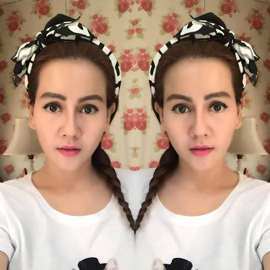 Nita puas dengan hasil plasan di wajahnya © Instagram/@nita.talia