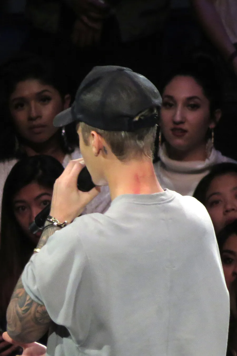 Ruam merah di leher Justin Bieber bekas kerokan? © splashnews.com