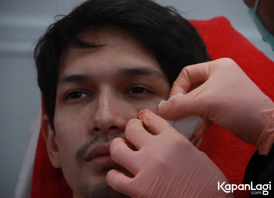 Dimas Beck ingin menghilangkan mata pandanya © KapanLagi.com/Muhammad Akrom Sukarya