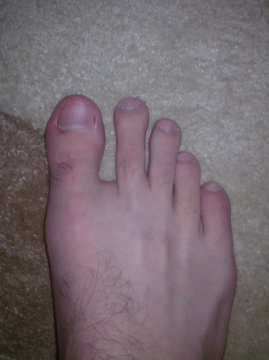 Apa kakimu berbentuk Roman foot?