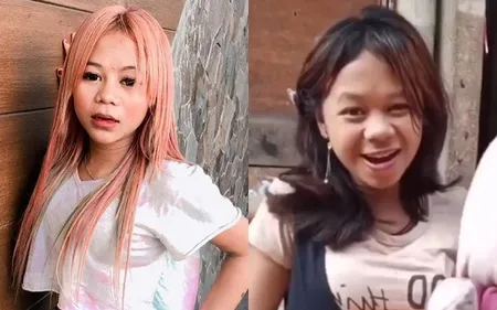 7 Foto Jadul Cimoy Montok Sebelum Glow Up Penampilannya Jadi Perhatian Netizen Kapanlagi Com