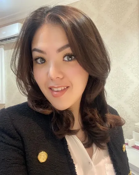 Dagu dan Hidung Makin Lancip, Potret Tina Toon dengan Wajah Tirus Bikin Netizen Curiga Oplas