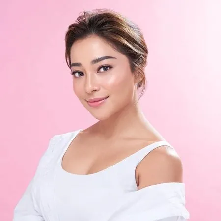 Dikenal Cantik Paripurna, Ini Potret Nikita Willy Ketika Wajahnya Berjerawat Hingga Sempat Merasa Minder
