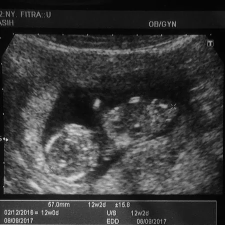 Foto Hamil 15 Minggu Perut Fita Anggriani Ilham Mulai Membuncit Kapanlagi Com