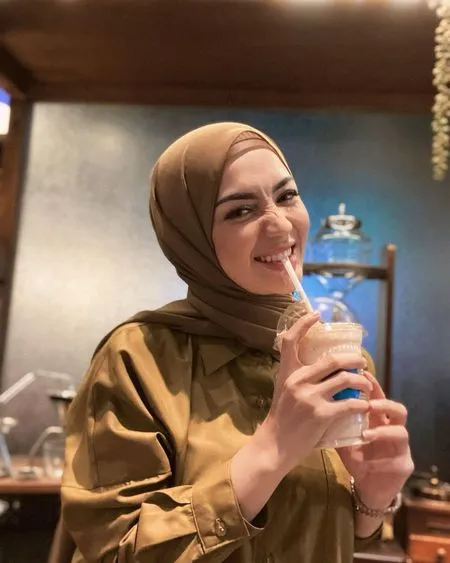 Foto Imel Putri Cahyati yang Tengah Berjuang Melawan Kanker, Tetap Ceria dan Terlihat Lebih Kurus