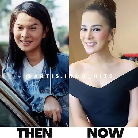 Foto Jadulnya Viral Usai Beredar di Socmed, Astrid Tiar Kembali Dituduh Operasi Plastik
