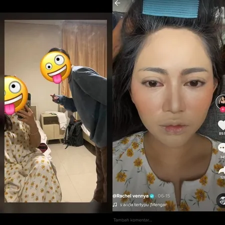 Ramai Dihujat Netizen, 6 Potret Kronologi Rachel Vennya Diduga Sempat Karantina dan Sekamar dengan Salim Nauderer