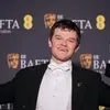 Robert Aramayo Kalahkan Leonardo DiCaprio - Timothee Chalamet di BAFTA Awards 2026