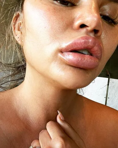 Weekly Hot IG: Foto Baby Bump Meghan Markle - Bibir Chrissy Teigen Bengkak Karena Kulit Jeruk