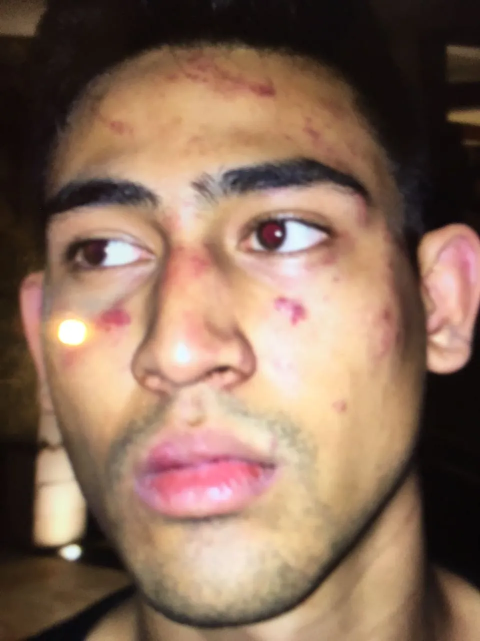 Axel Thomas, putra Jeremy Thomas yang mengalami penyiksaan dan penyekapan oleh oknum yang mengaku polisi © dok. pribadi