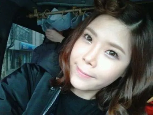 Kurang pede, Lyn akui melakukan operasi plastik ©kpopstarz.com