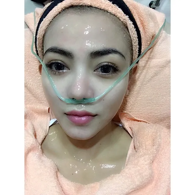 Bella Shofie lakukan perawatan © Instagram/