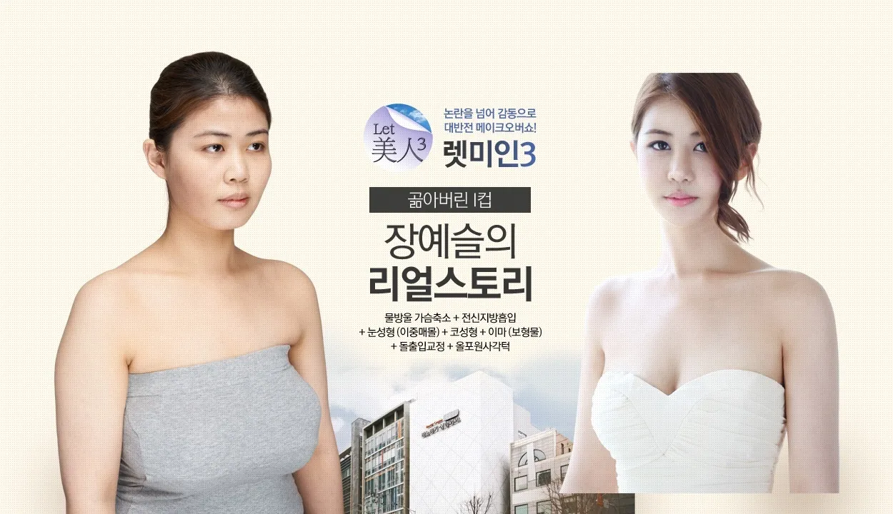 Hasil operasi plastik @foto: Koreaboo.com