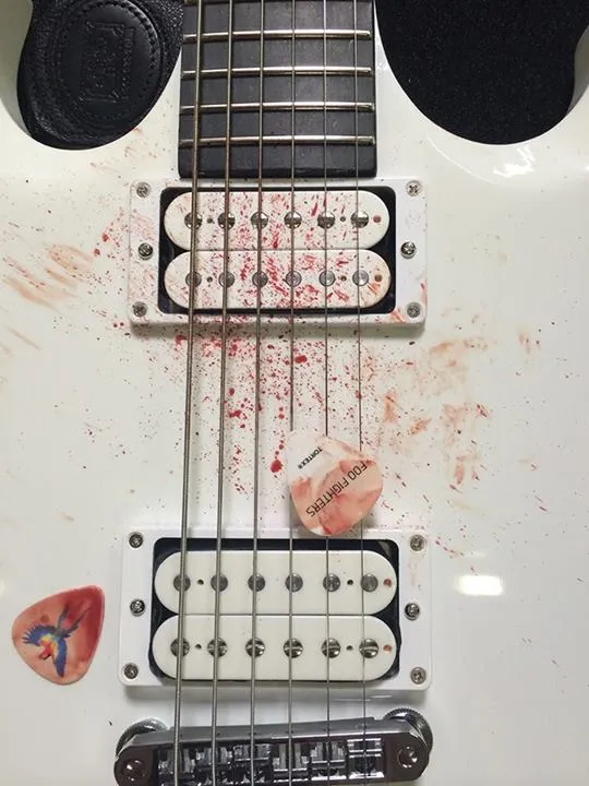 Noda darah di gitar Dave Grohl. ©Facebook / foofighters
