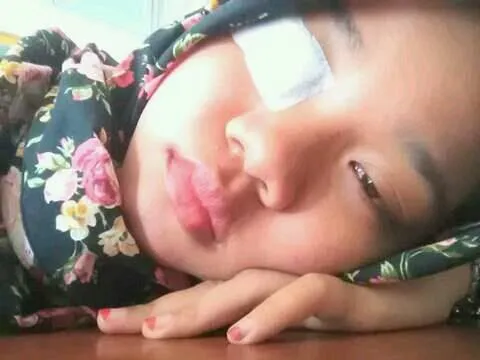 Mata seorang gadis terluka di KM 0 Kulonprogo akibat terkena puntung rokok yang dibuang sembarangan © Facebook.com/Candra Chandra Candrua