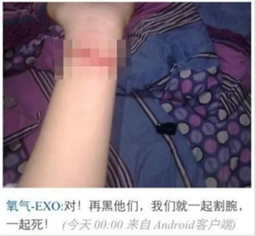 Memotong pergelangan tangan lantaran tak terima idola dikritik. Tindakan dewasa? ©en.korea.com