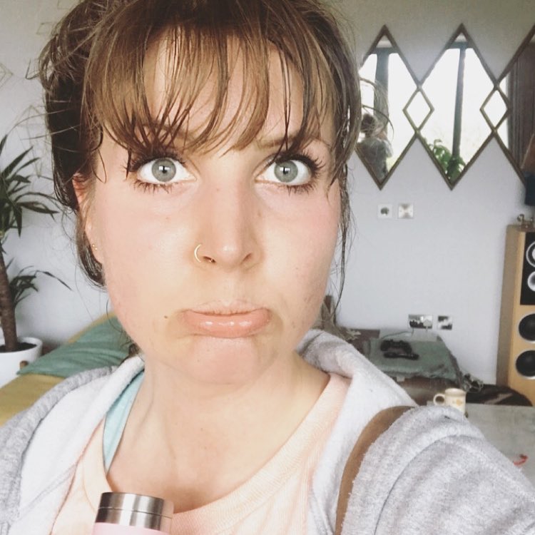 Setelah perjuangan panjang kini Amy kembali percaya diri tanpa makeup. © instagram.com/amy_skyntherapy