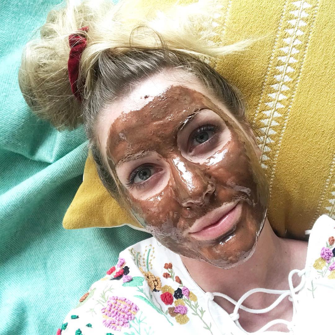 Kini Amy mulai melakukan pengaturan pola makan dan perawatan wajah alami. Š instagram.com/amy_skyntherapy/