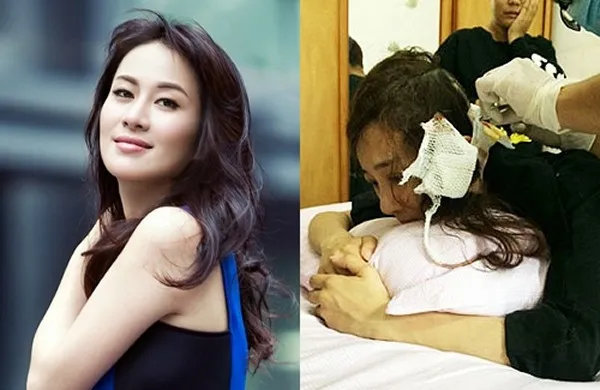 Li Yixiao menderita luka-luka akibat gigitan anjing Michelle Ye. ©lollipop.sg