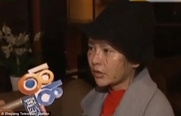 Kondisi wajah Tian setelah diserang teman sekamarnya karena jadi terlalu cantik © dailymail.co.uk