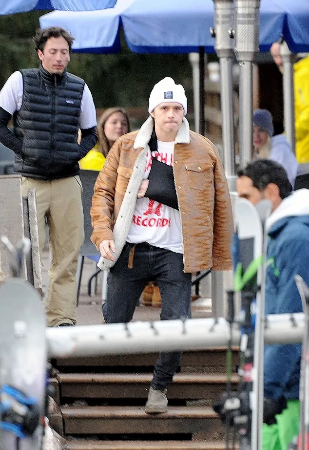 Brooklyn masih tetap stylish walau tangannya sakit © via dailymail.co.uk