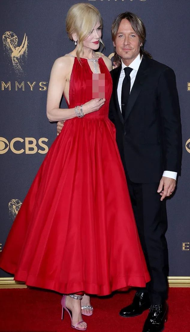 Nicole Kidman mengenakan sepatu dengan model yang berbeda antara kiri dan kanan © Shutterstock via dialymail.co.uk