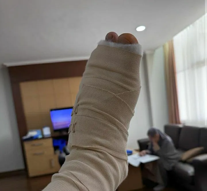 Hanung Bramantyo Alami Patah Tulang Setelah Ketiban Motor 220 Kg / Credit Foto: Instagram/hanungbramantyo