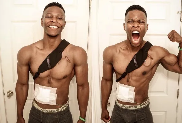 Andrew Jones, pasien gagal jantung yang gunakan jantung buatan untuk tetap hidup © upworthy.com