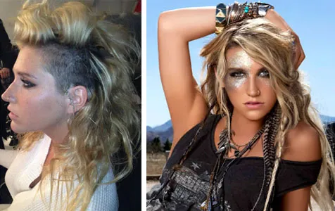 Kesha