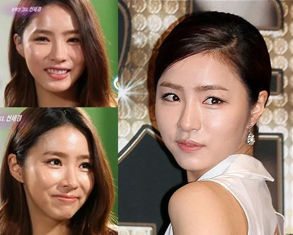 Tampak berbeda. Apakah Shin Se Kyung melakukan operasi plastik? ©soompi.com