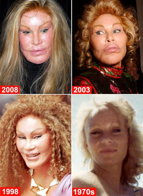 Jocelyn Wildenstein