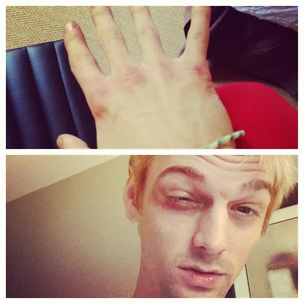 Aaron Carter @foto: instagram