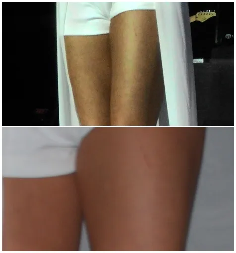 Kaki Agnez Mo tampak tergores. ©KapanLagi.com®/sjw/sry