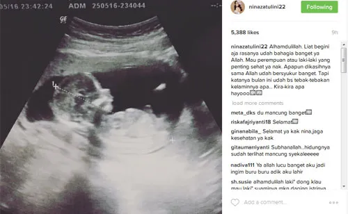 Nina Zatulini tunjukan hasil USG © Instagram.com/ninazatulini22